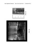 AQUABLATION AQUABEAM EYE SURGERY METHODS AND APPARATUS diagram and image