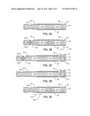 TRACTION-LIMITING VITRECETOMY PROBE diagram and image