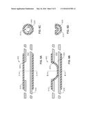 TRACTION-LIMITING VITRECETOMY PROBE diagram and image