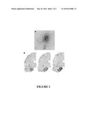 METHOD FOR PREVENTING AND/OR TREATING CHRONIC TRAUMATIC ENCEPHALOPATHY-I diagram and image