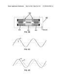 Methods and Treatment for Certain Demyelination and Dysmyelination-Based     Disorders and/or Promoting Remyelination diagram and image