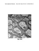 Methods and Treatment for Certain Demyelination and Dysmyelination-Based     Disorders and/or Promoting Remyelination diagram and image