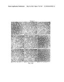 Methods and Treatment for Certain Demyelination and Dysmyelination-Based     Disorders and/or Promoting Remyelination diagram and image