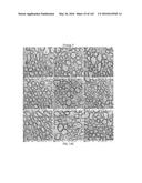 Methods and Treatment for Certain Demyelination and Dysmyelination-Based     Disorders and/or Promoting Remyelination diagram and image