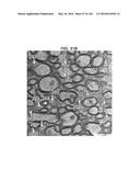 Methods and Treatment for Certain Demyelination and Dysmyelination-Based     Disorders and/or Promoting Remyelination diagram and image