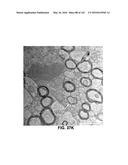 Methods and Treatment for Certain Demyelination and Dysmyelination-Based     Disorders and/or Promoting Remyelination diagram and image