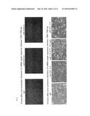 GENE-MODIFIED COXSACKIEVIRUS diagram and image