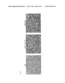 GENE-MODIFIED COXSACKIEVIRUS diagram and image