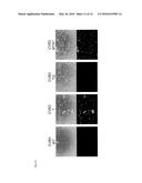 GENE-MODIFIED COXSACKIEVIRUS diagram and image