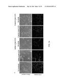 TREATMENT OF AUTISM SPECTRUM DISORDERS WITH CILIARY NEUROTROPHIC FACTOR     PEPTIDE MIMETIC diagram and image