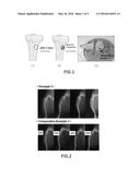 COMPOSITION FOR NEW BONE FORMATION, AND NEW BONE FORMATION SYSTEM diagram and image