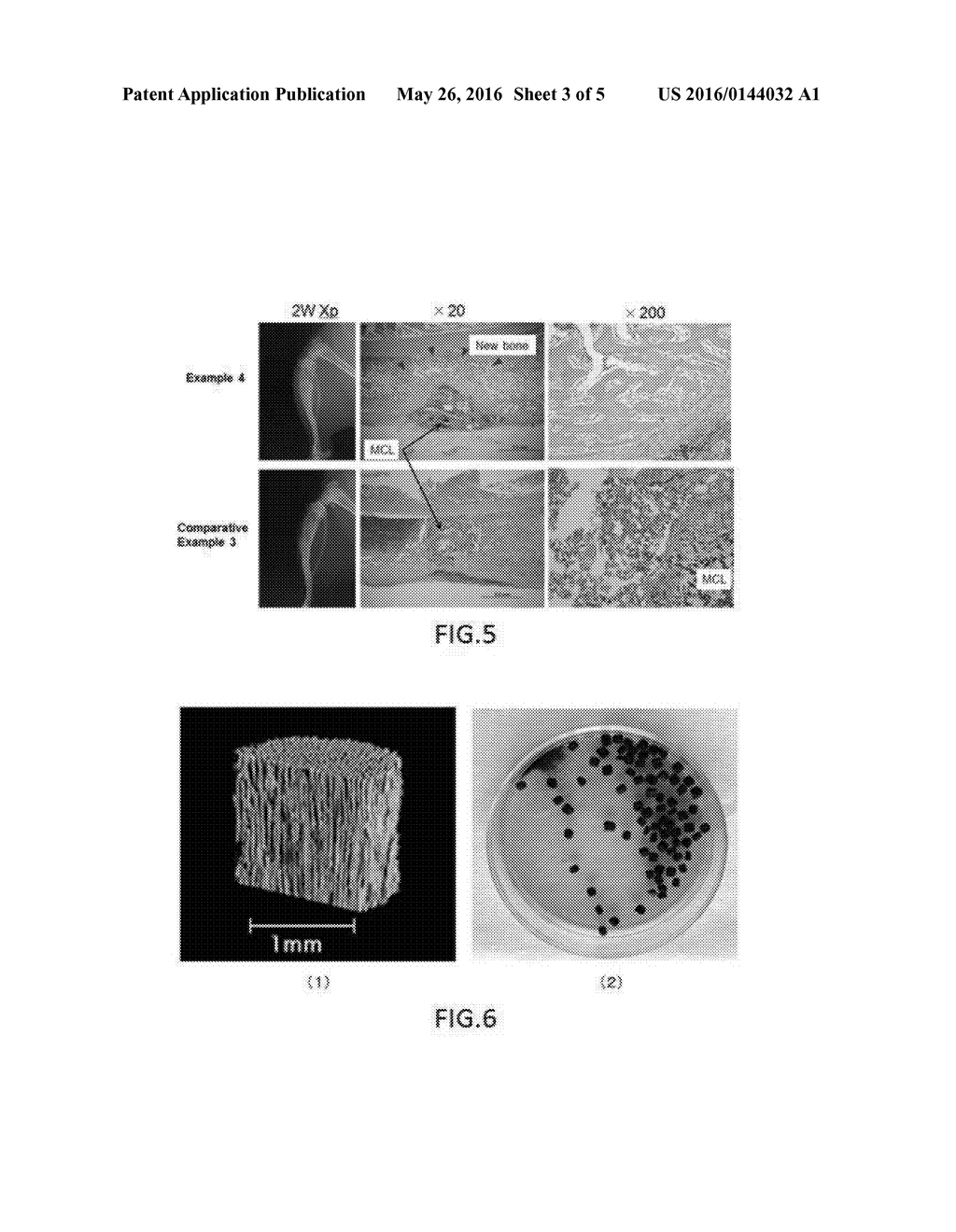 COMPOSITION FOR NEW BONE FORMATION, AND NEW BONE FORMATION SYSTEM - diagram, schematic, and image 04