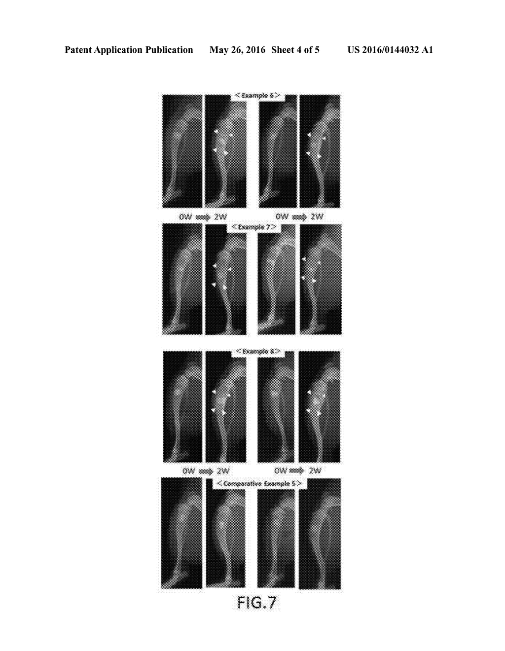 COMPOSITION FOR NEW BONE FORMATION, AND NEW BONE FORMATION SYSTEM - diagram, schematic, and image 05