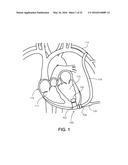 PUMP AND METHOD FOR MIXED FLOW BLOOD PUMPING diagram and image