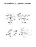 PUMP AND METHOD FOR MIXED FLOW BLOOD PUMPING diagram and image