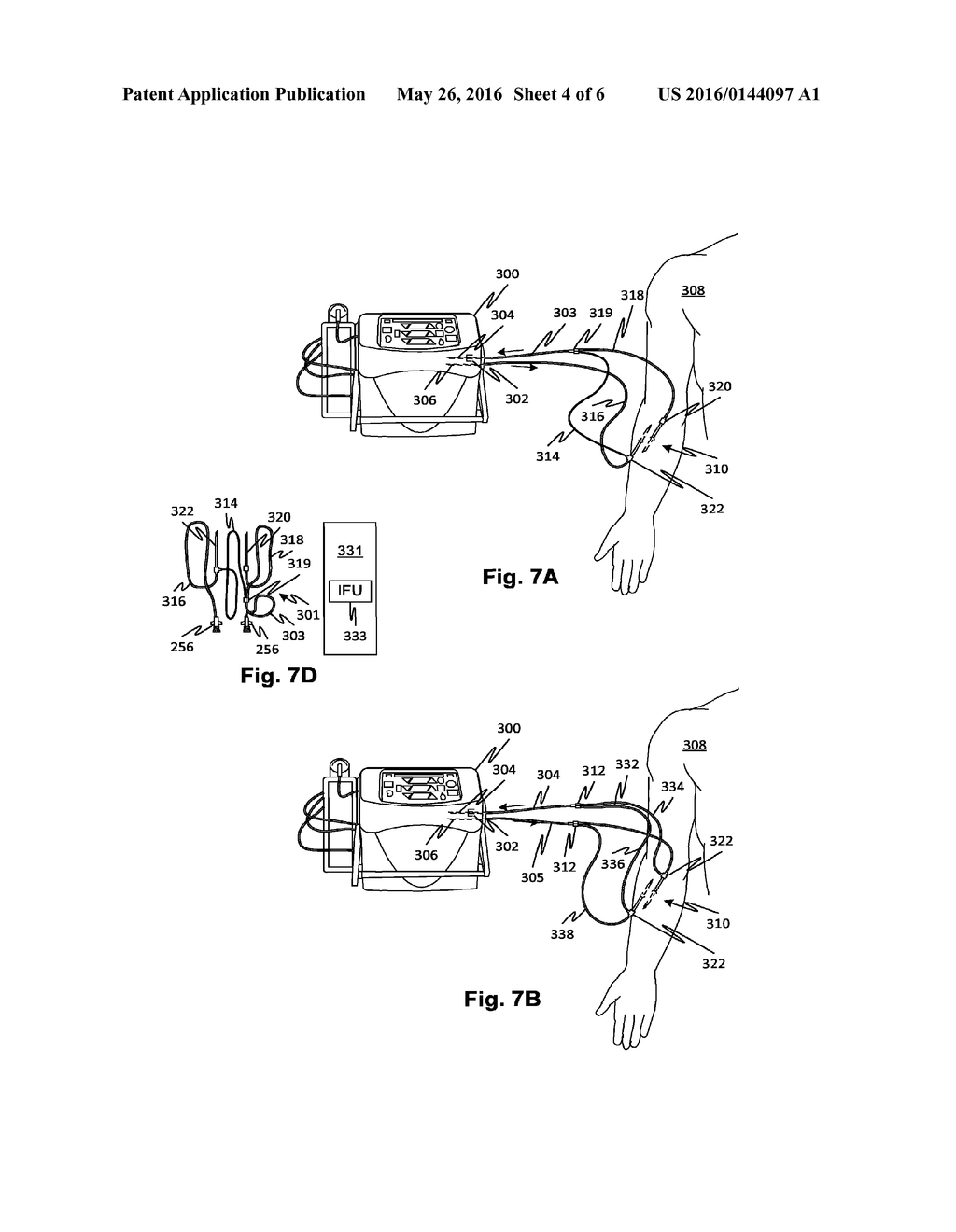 FLUID CONVEYANCE SAFETY DEVICES, METHODS, AND SYSTEMS - diagram, schematic, and image 05