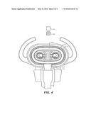 PATIENT NASAL INTERFACE FOR USE WITH A NASAL AIRWAY PRESSURE SYSTEM diagram and image