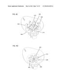 SYSTEMS, DEVICES, AND METHOD FOR TREATING A SINUS CONDITION diagram and image