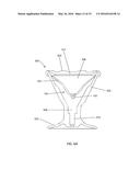 SYSTEMS, DEVICES, AND METHOD FOR TREATING A SINUS CONDITION diagram and image