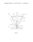 SYSTEMS, DEVICES, AND METHOD FOR TREATING A SINUS CONDITION diagram and image