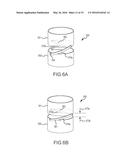 Coupler assembly for catheters diagram and image