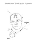 DISTURBING MAGNETIC RESONANCE IMAGING (MRI) IMAGES USING IMPLANTABLE     MEDICAL DEVICE diagram and image