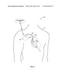 DISTURBING MAGNETIC RESONANCE IMAGING (MRI) IMAGES USING IMPLANTABLE     MEDICAL DEVICE diagram and image