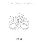 CARDIAC PACING SENSING AND CONTROL diagram and image