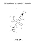 CARDIAC PACING SENSING AND CONTROL diagram and image