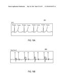 CARDIAC PACING SENSING AND CONTROL diagram and image