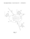 INTENSITY-MODULATED PROTON THERAPY diagram and image