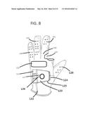 GOLF GLOVE WITH APERTURE FOR ENHANCED TACTILE CAPABILITIES diagram and image