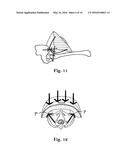 Vehicular child restraint and child protection system diagram and image