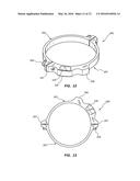 SUSPENSION LIMITING DEVICE, SYSTEM AND METHOD diagram and image