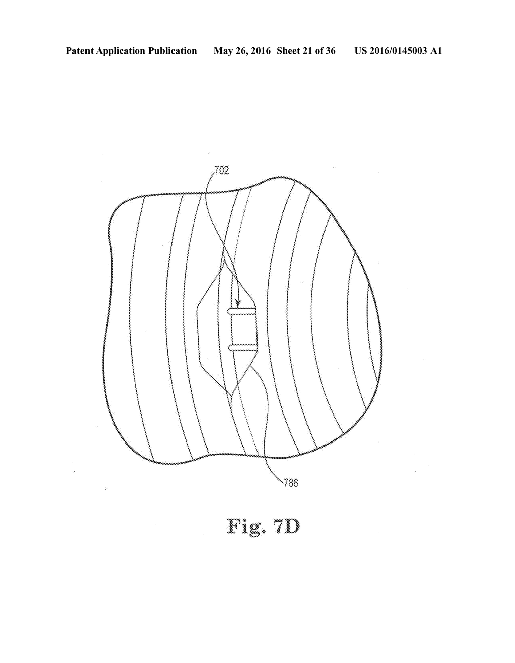 NESTED BLOW MOLDED LINER AND OVERPACK AND METHODS OF MAKING SAME - diagram, schematic, and image 22