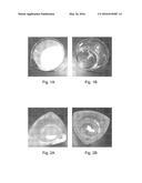 ASPHALTENE-DISSOLVING OIL-EXTERNAL EMULSION FOR ACIDIZATION AND METHODS OF     USING THE SAME diagram and image