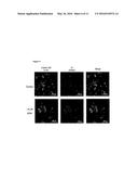 KIT AND METHOD FOR PROMOTING MESENCHYMAL STEM CELL DIFFERENTIATION diagram and image