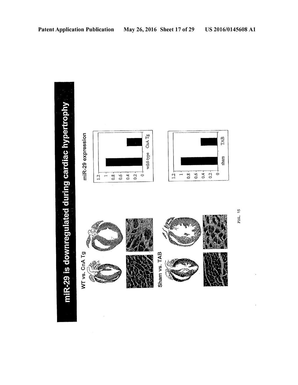 MICRO-RNA FAMILY THAT MODULATES FIBROSIS AND USES THEREOF - diagram, schematic, and image 18