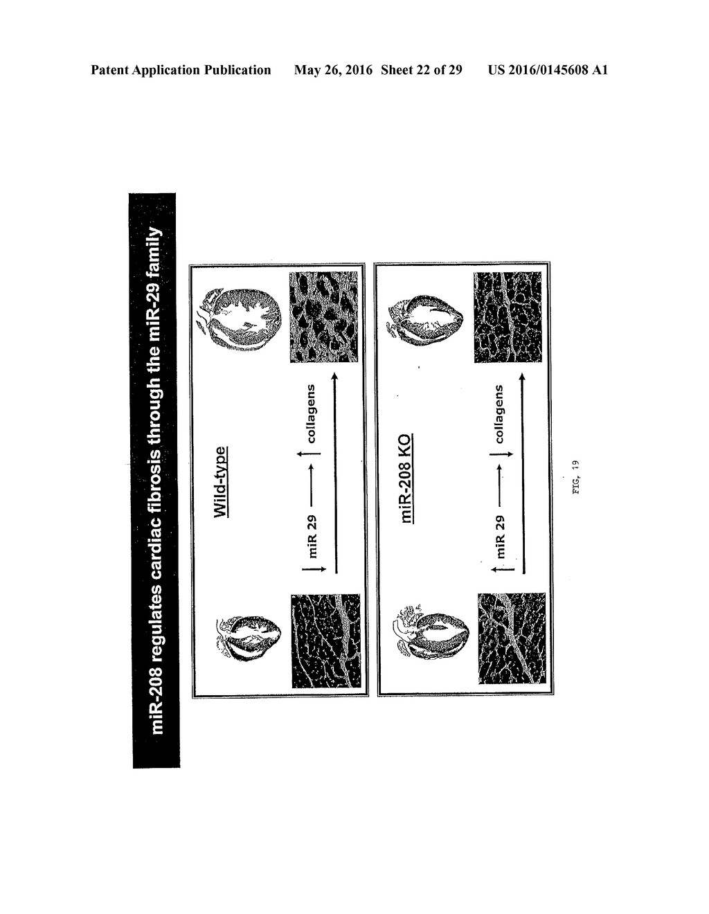 MICRO-RNA FAMILY THAT MODULATES FIBROSIS AND USES THEREOF - diagram, schematic, and image 23