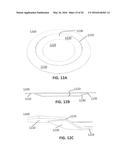 FRUSTUM-SHAPED RUPTURE DISK HAVING LINE OF WEAKNESS diagram and image