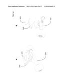 ELASTOMER ENCASED MOTION SENSOR PACKAGE diagram and image