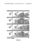 COMPOSITIONS AND METHODS FOR PROGNOSIS AND TREATMENT OF CANCER diagram and image