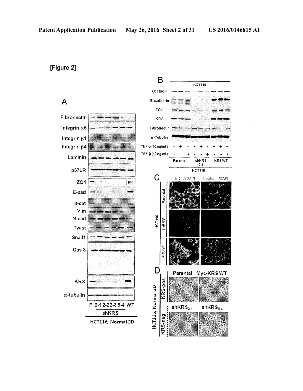 METHOD FOR SCREEING CANCER METASTASIS INHIBITOR USING CULTURE OF CELLS OR     SPHEROIDICALLY AGGREGATED CELLS IN WHICH LYSYL-TRNA SYNTHETASE IS     REGULATED TO BE EXPRESSED OR UNEXPRESSED - diagram, schematic, and image 03