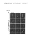 METHOD FOR SCREEING CANCER METASTASIS INHIBITOR USING CULTURE OF CELLS OR     SPHEROIDICALLY AGGREGATED CELLS IN WHICH LYSYL-TRNA SYNTHETASE IS     REGULATED TO BE EXPRESSED OR UNEXPRESSED diagram and image