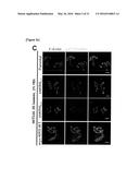 METHOD FOR SCREEING CANCER METASTASIS INHIBITOR USING CULTURE OF CELLS OR     SPHEROIDICALLY AGGREGATED CELLS IN WHICH LYSYL-TRNA SYNTHETASE IS     REGULATED TO BE EXPRESSED OR UNEXPRESSED diagram and image