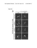 METHOD FOR SCREEING CANCER METASTASIS INHIBITOR USING CULTURE OF CELLS OR     SPHEROIDICALLY AGGREGATED CELLS IN WHICH LYSYL-TRNA SYNTHETASE IS     REGULATED TO BE EXPRESSED OR UNEXPRESSED diagram and image