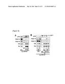 METHOD FOR SCREEING CANCER METASTASIS INHIBITOR USING CULTURE OF CELLS OR     SPHEROIDICALLY AGGREGATED CELLS IN WHICH LYSYL-TRNA SYNTHETASE IS     REGULATED TO BE EXPRESSED OR UNEXPRESSED diagram and image