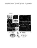 CLASSIFICATION SYSTEM, METHODS AND KIT FOR CLASSIFYING, PREDICTING AND     TREATING BREAST CANCER diagram and image