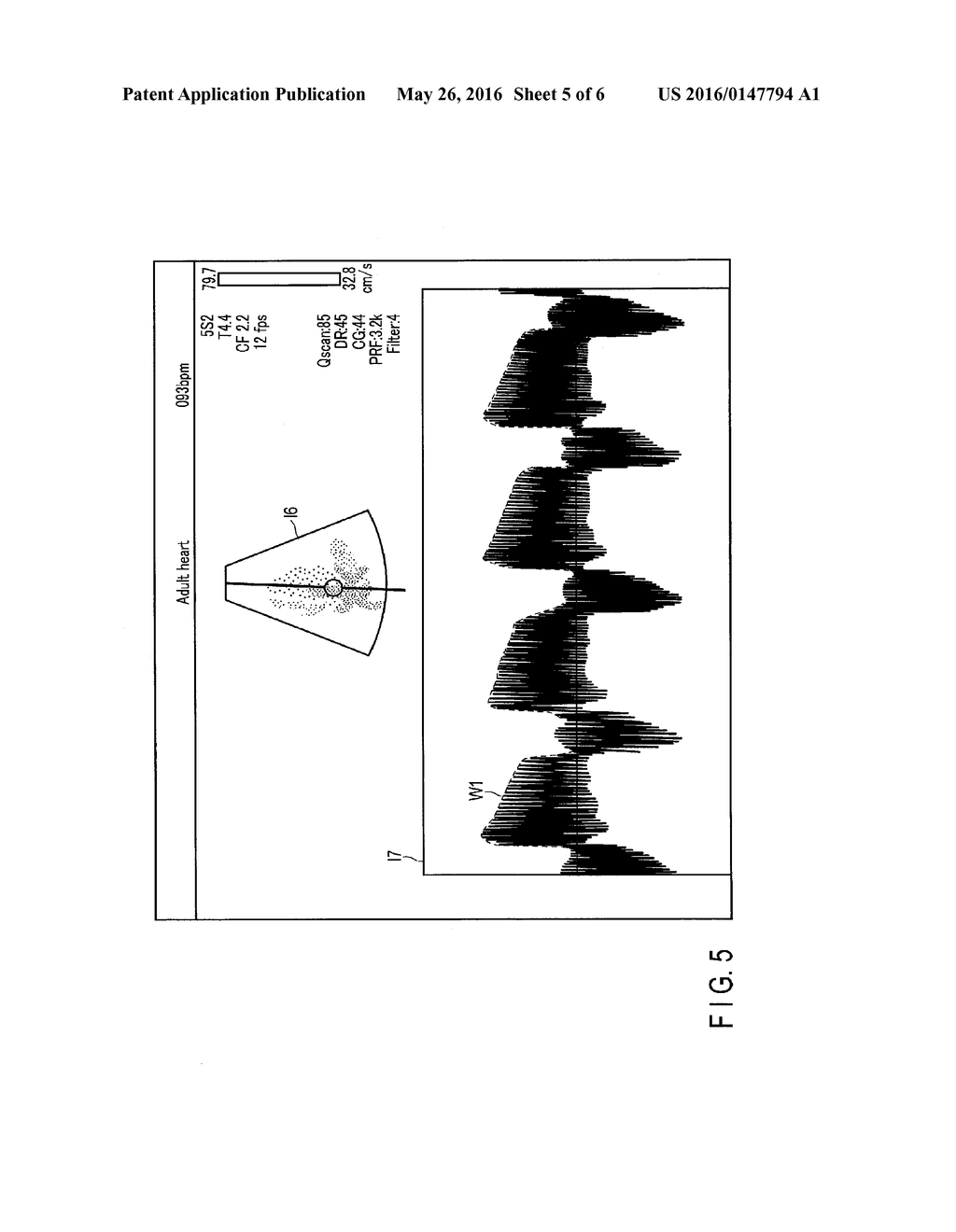 ULTRASONIC DIAGNOSTIC APPARATUS, MEDICAL IMAGE PROCESSING APPARATUS, AND     MEDICAL IMAGE PROCESSING METHOD - diagram, schematic, and image 06