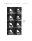 Systems and Methods for Three-Dimensional Spiral Perfusion Imaging diagram and image